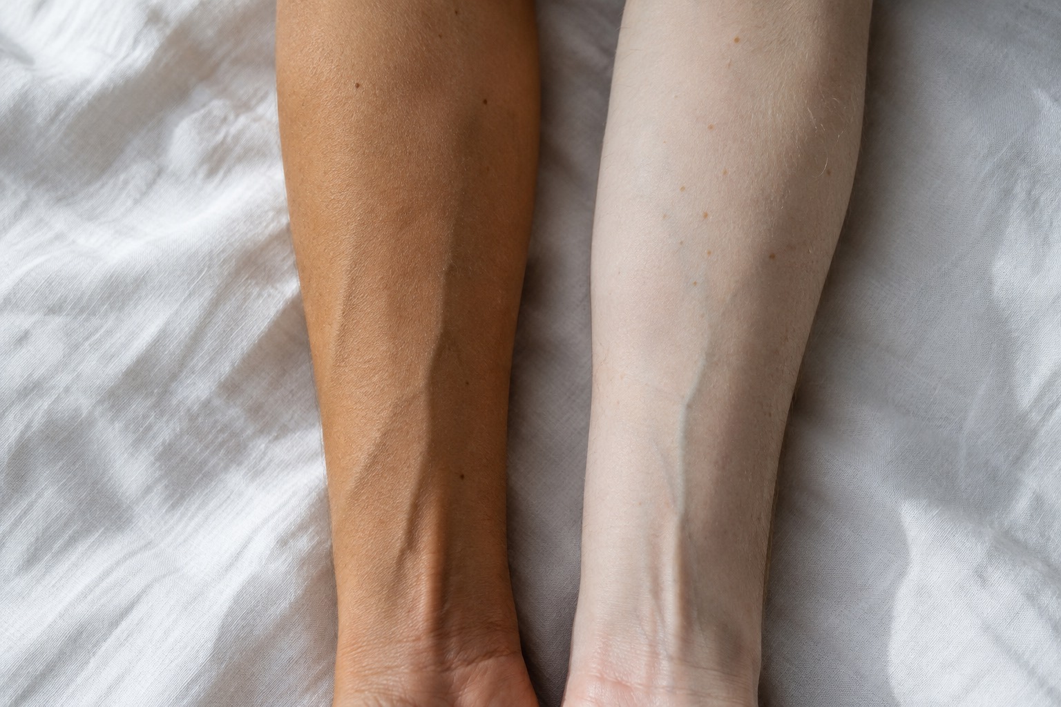 Tanned forearm held beside a pale one in soft daylight on a neutral background